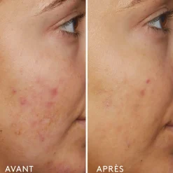B3 Nice 10% Niacinamide Sérum Rééquilibrant